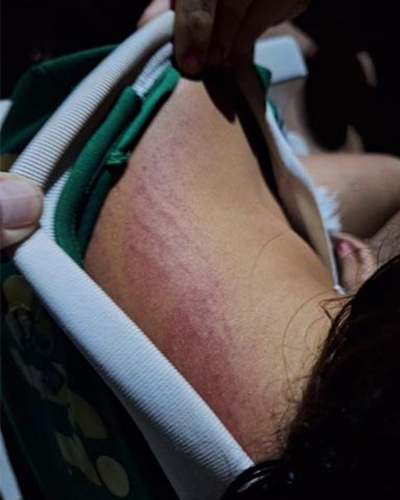 MIGUEL ALVES/PI: APÓS SER AGREDIDA PELA MÃE MENINA DE 12 ANOS PEDE MEDIDA PROTETIVA